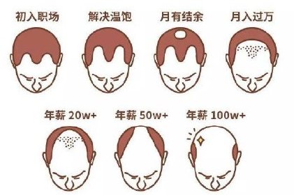 中国脱发人口_你不是一个人在脱发,我国超2.5亿人正在饱受脱发困扰